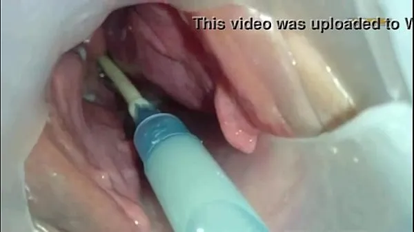 Grote Sperm injected into the uterus of the wife of others nieuwe video's