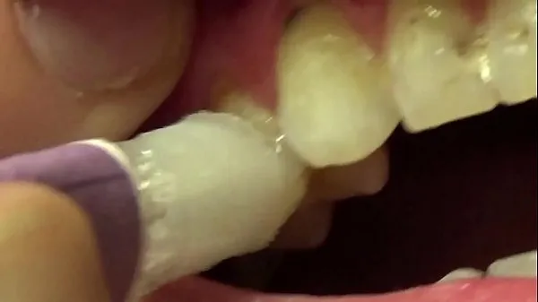 วิดีโอใหม่ยอดนิยม Applying Whitening Paste To Her Filthy Teeth รายการ