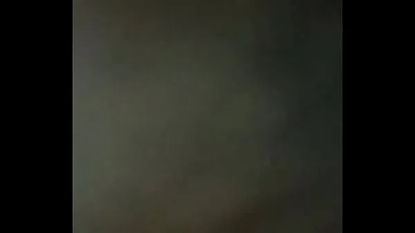 Velká Vitiligo nová videa